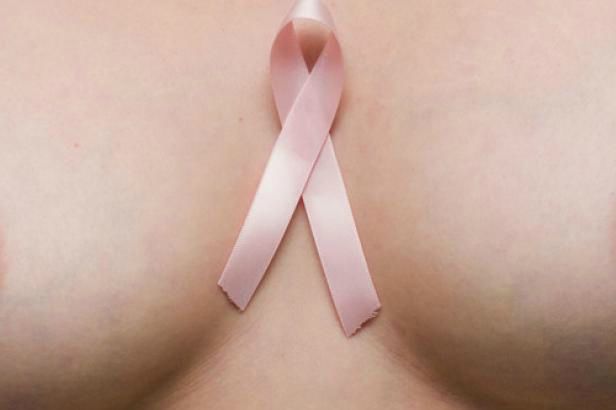 breast_cancer