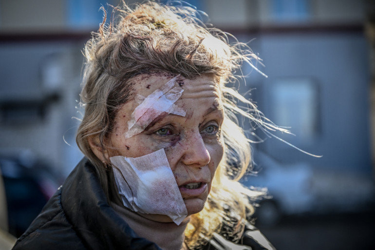 1493305-une-femme-blessee-devant-un-hopital-apres-le-bombardement-de-la-ville-de-chuguiv-dans-l-est-de-l-ukraine-le-24-fevrier-2022