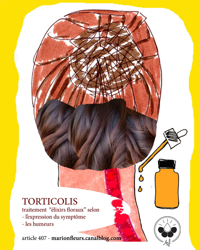 Torticolis guéri uniquement avec un mélange floral