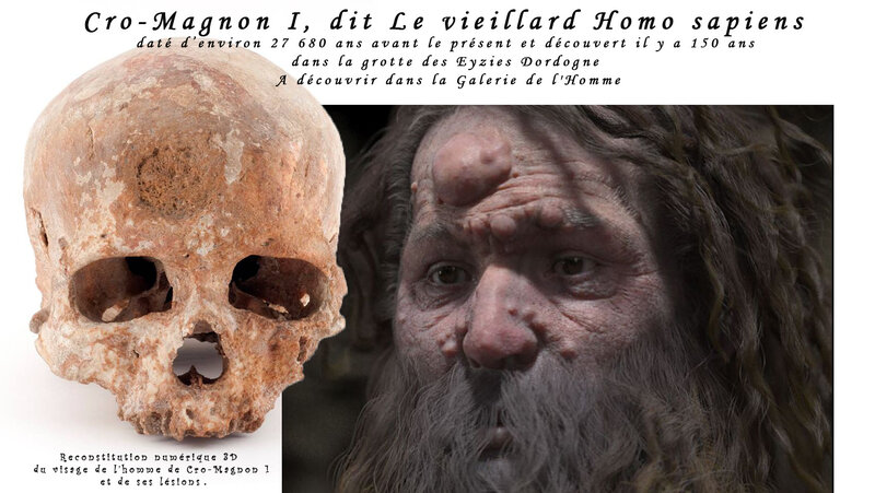 Cro-Magnon I, dit Le vieillard Homo sapiens, daté d’environ 27 680 ans avant le présent et découvert il y a 150 ans dans la grotte des Eyzies Dordogne A découvrir dans la Galerie de l'Homme